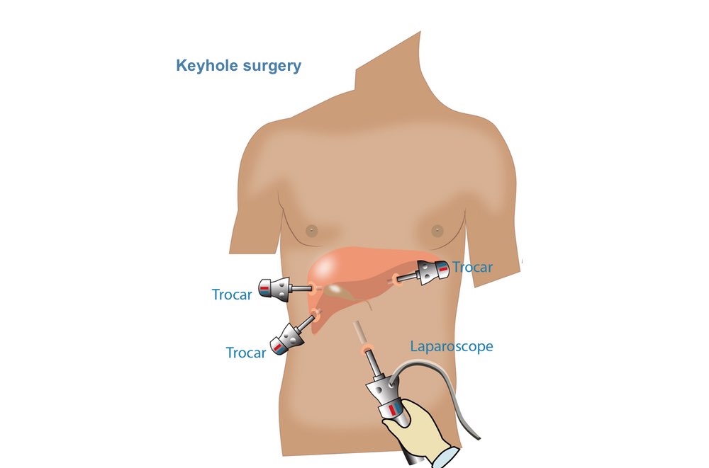 types of surgery